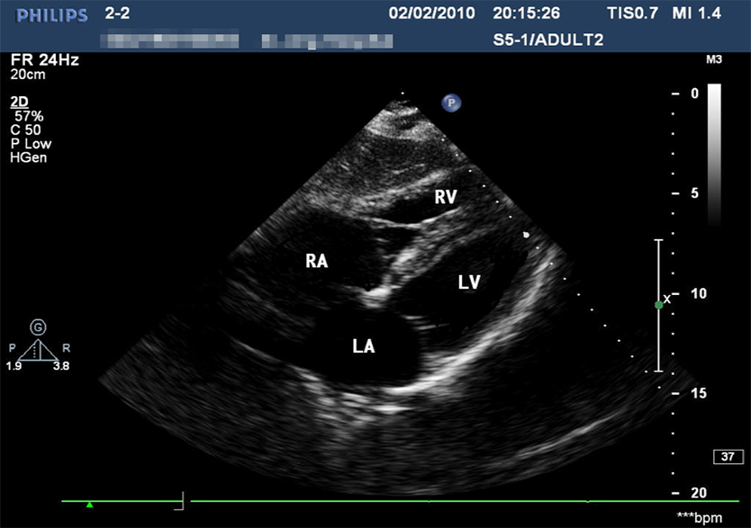 創(chuàng)傷超聲重點(diǎn)評估平臺2.0