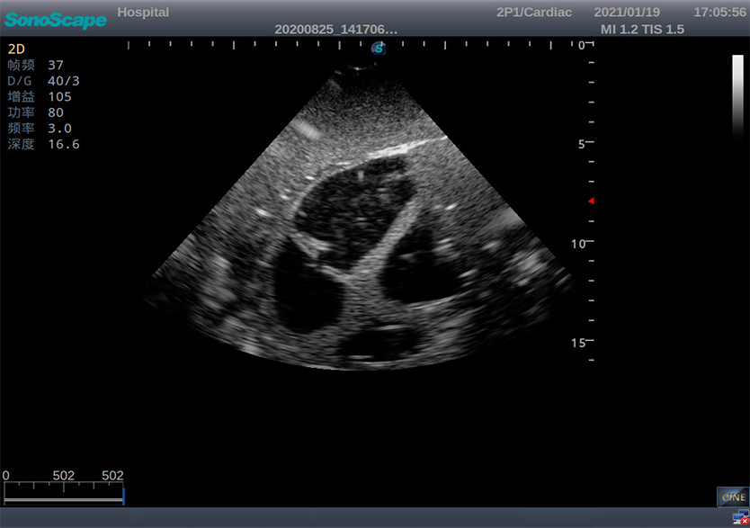創(chuàng)傷超聲重點(diǎn)評估平臺2.0